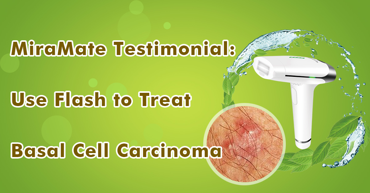 Use Flash to Treat Basal Cell Carcinoma