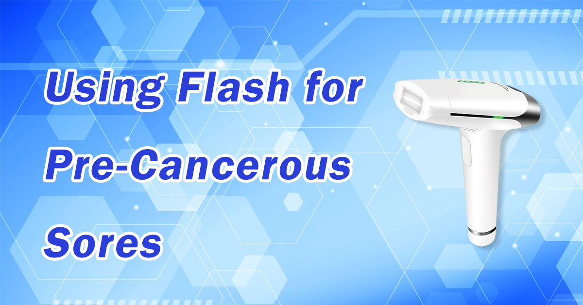 Using Flash for Pre-Cancerous Sores