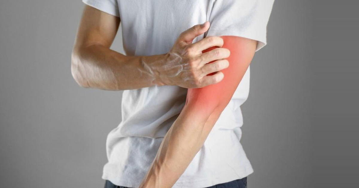 Arm Pain