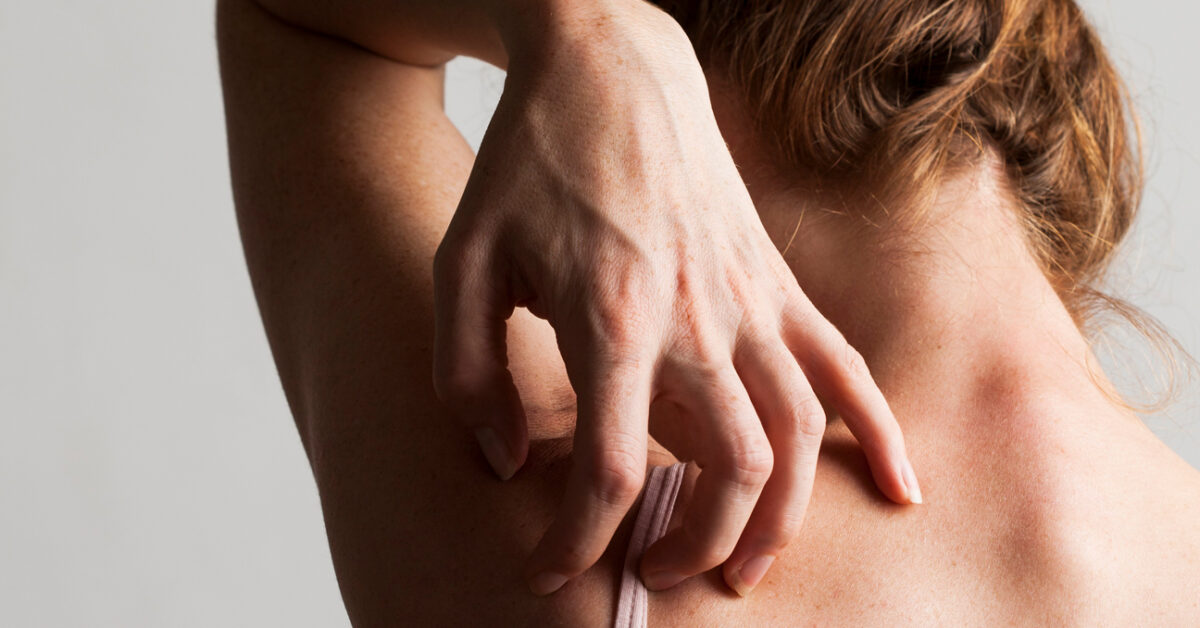 Ray Gun Amazing for Scabies