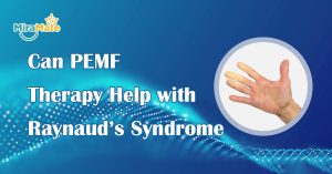 Can-PEMF-Therapy-Help-with-Raynaud’s-Syndrome